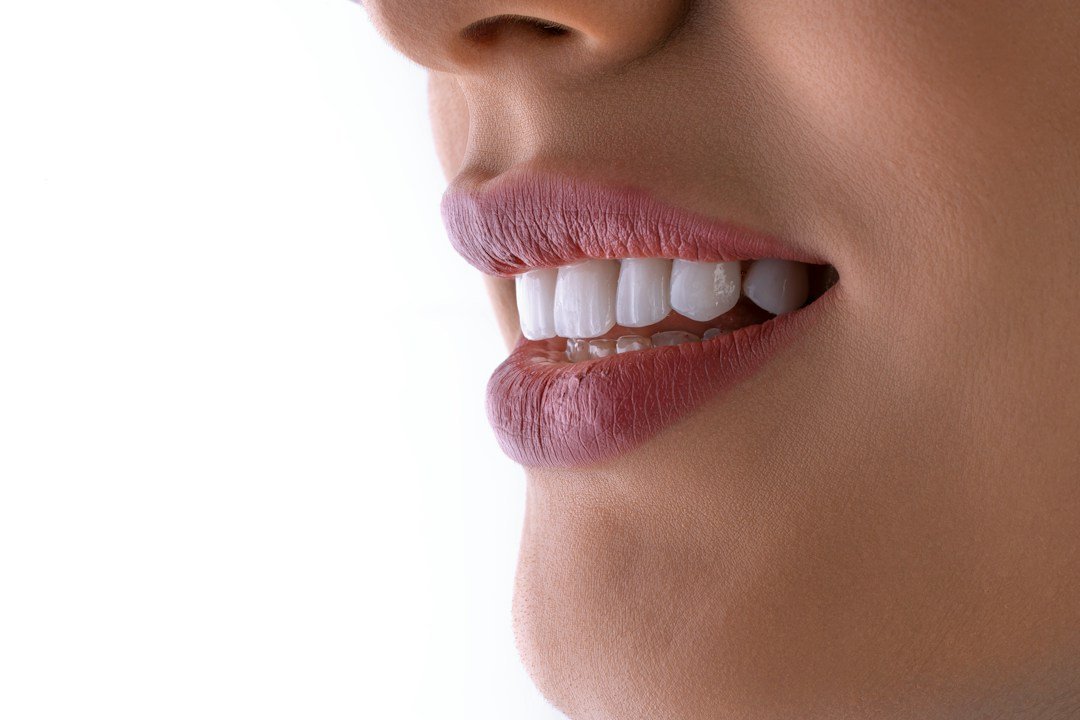 Smile whitening and dental care related to Brasssmile Com